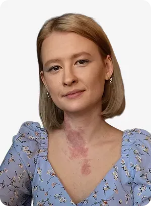 Анжелика Ялова